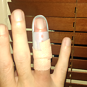 Craig's finger